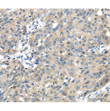 Immunohistochemistry - UGP2 Antibody from Signalway Antibody (40177) - Antibodies.com