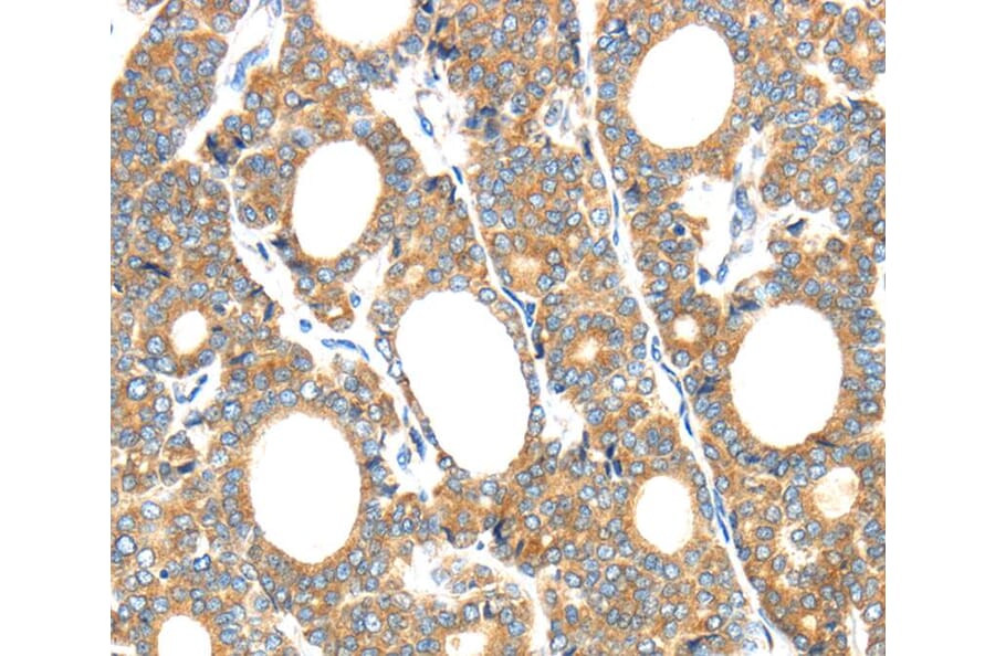 Immunohistochemistry - GZMK Antibody from Signalway Antibody (40180) - Antibodies.com