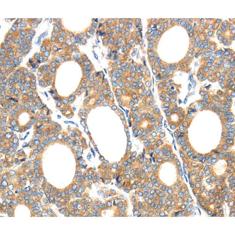 Immunohistochemistry - GZMK Antibody from Signalway Antibody (40180) - Antibodies.com