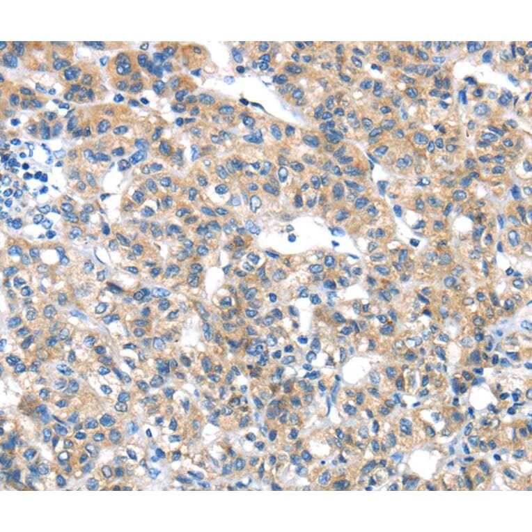 Immunohistochemistry - GZMK Antibody from Signalway Antibody (40180) - Antibodies.com