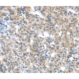 Immunohistochemistry - GZMK Antibody from Signalway Antibody (40180) - Antibodies.com