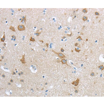 Immunohistochemistry - HCN4 Antibody from Signalway Antibody (40181) - Antibodies.com