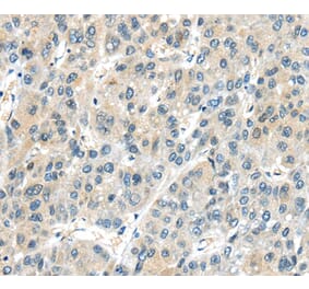 Immunohistochemistry - AHI1 Antibody from Signalway Antibody (40189) - Antibodies.com