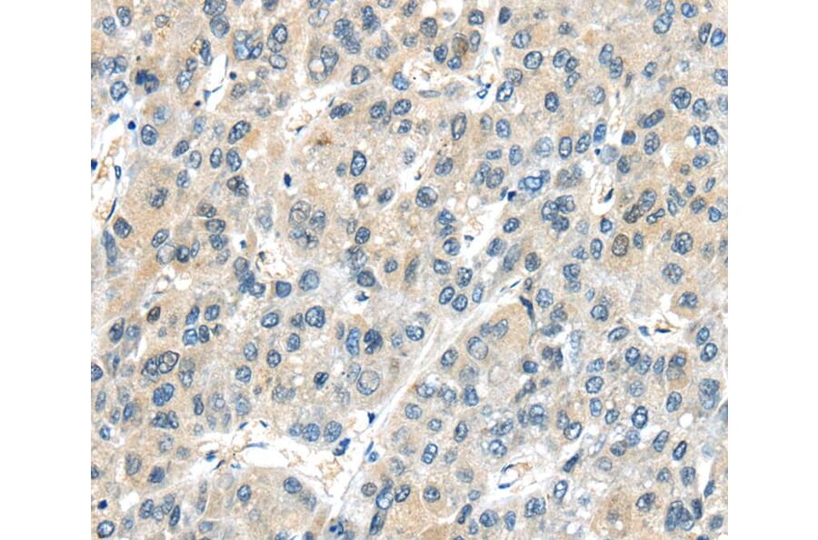 Immunohistochemistry - AHI1 Antibody from Signalway Antibody (40189) - Antibodies.com