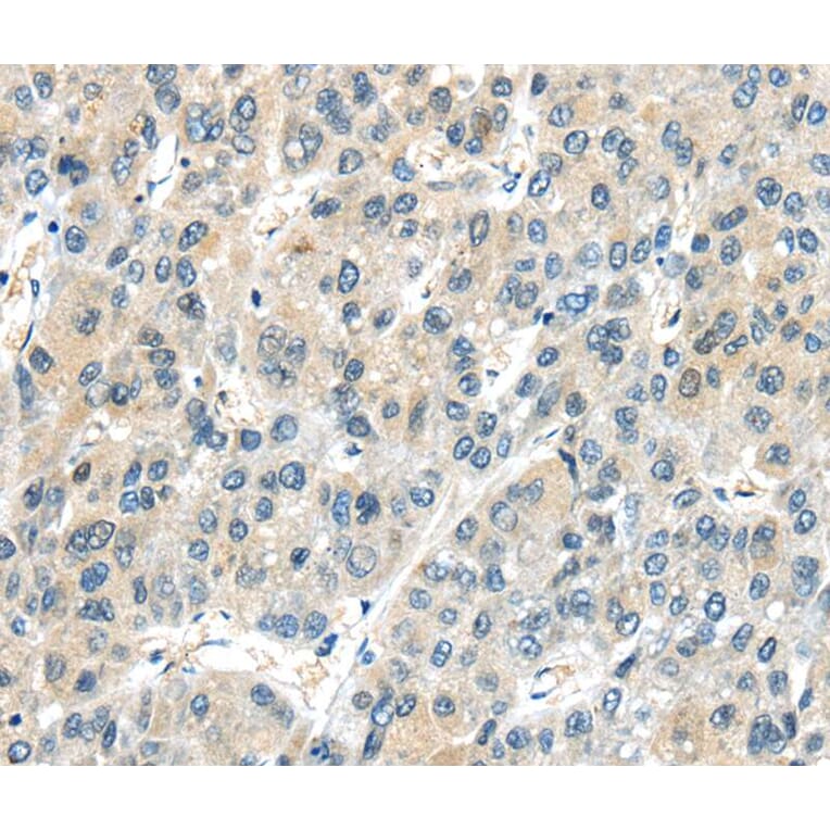 Immunohistochemistry - AHI1 Antibody from Signalway Antibody (40189) - Antibodies.com