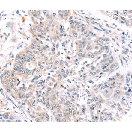 Immunohistochemistry - ROR1 Antibody from Signalway Antibody (40217) - Antibodies.com