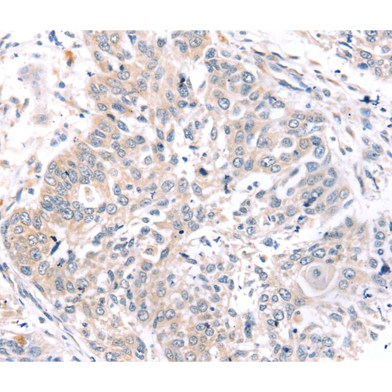 Immunohistochemistry - ROR1 Antibody from Signalway Antibody (40217) - Antibodies.com