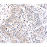 Immunohistochemistry - ROR1 Antibody from Signalway Antibody (40217) - Antibodies.com