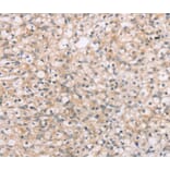 Immunohistochemistry - ROR1 Antibody from Signalway Antibody (40217) - Antibodies.com