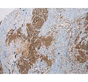 Immunohistochemistry - SSX2 Antibody from Signalway Antibody (40223) - Antibodies.com