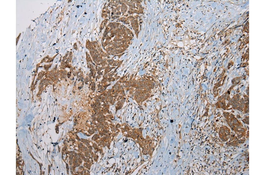 Immunohistochemistry - SSX2 Antibody from Signalway Antibody (40223) - Antibodies.com