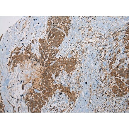 Immunohistochemistry - SSX2 Antibody from Signalway Antibody (40223) - Antibodies.com