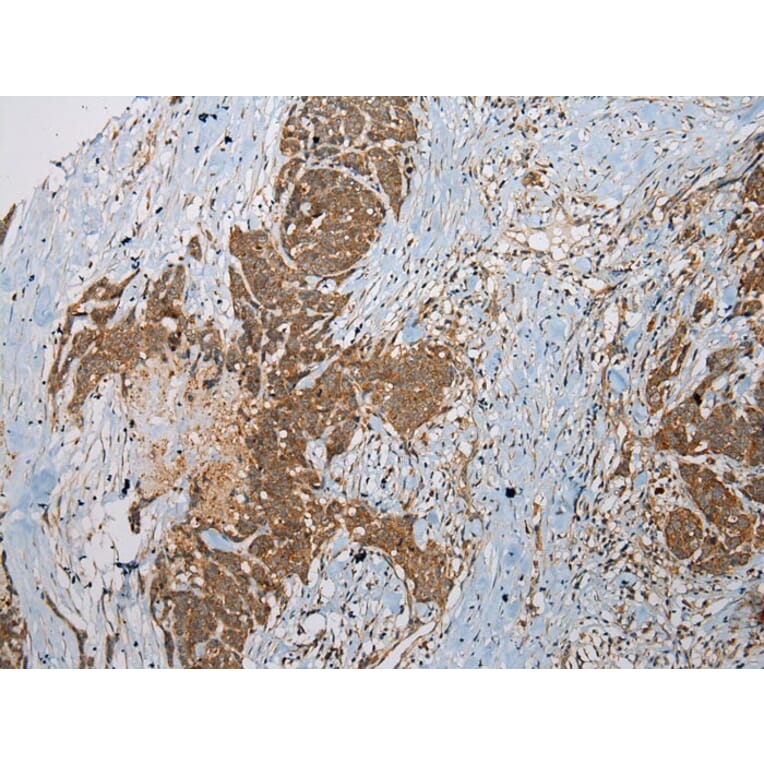 Immunohistochemistry - SSX2 Antibody from Signalway Antibody (40223) - Antibodies.com