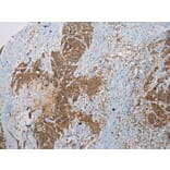 Immunohistochemistry - SSX2 Antibody from Signalway Antibody (40223) - Antibodies.com