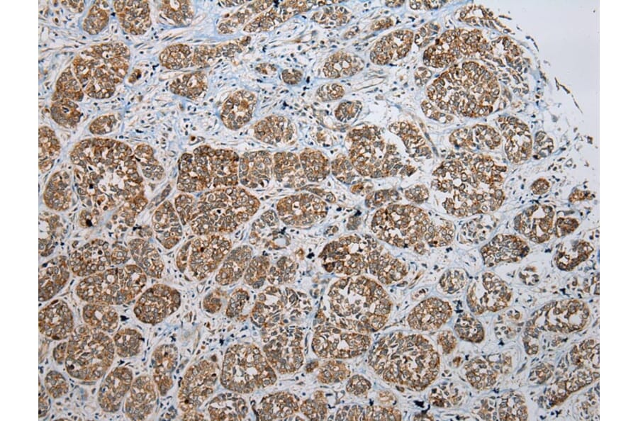 Immunohistochemistry - SSX2 Antibody from Signalway Antibody (40223) - Antibodies.com