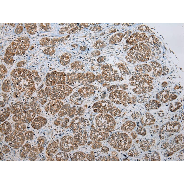 Immunohistochemistry - SSX2 Antibody from Signalway Antibody (40223) - Antibodies.com