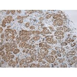 Immunohistochemistry - SSX2 Antibody from Signalway Antibody (40223) - Antibodies.com
