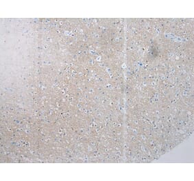 Immunohistochemistry - SSX4 Antibody from Signalway Antibody (40224) - Antibodies.com