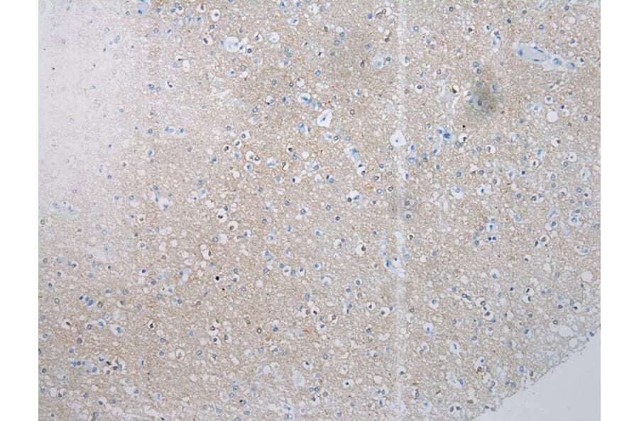 Immunohistochemistry - SSX4 Antibody from Signalway Antibody (40224) - Antibodies.com