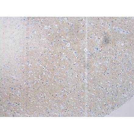 Immunohistochemistry - SSX4 Antibody from Signalway Antibody (40224) - Antibodies.com