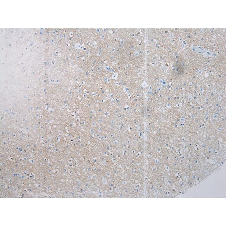 Immunohistochemistry - SSX4 Antibody from Signalway Antibody (40224) - Antibodies.com