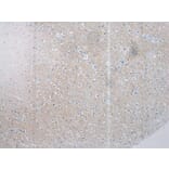 Immunohistochemistry - SSX4 Antibody from Signalway Antibody (40224) - Antibodies.com