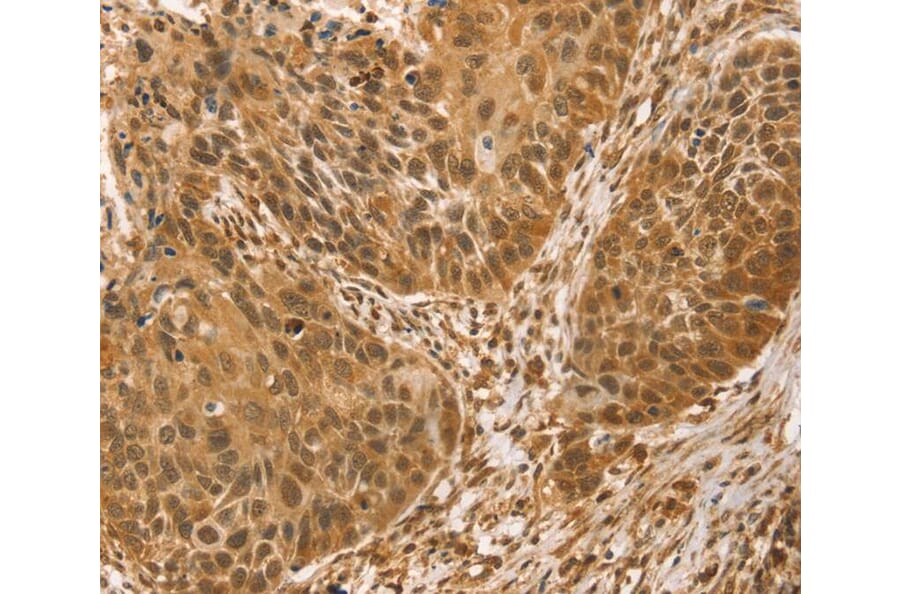 Immunohistochemistry - VMP1 Antibody from Signalway Antibody (40253) - Antibodies.com