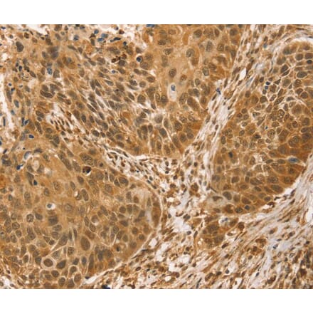 Immunohistochemistry - VMP1 Antibody from Signalway Antibody (40253) - Antibodies.com