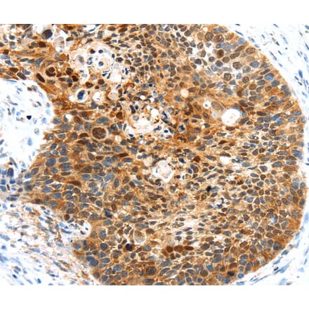 Immunohistochemistry - HUNK Antibody from Signalway Antibody (40261) - Antibodies.com