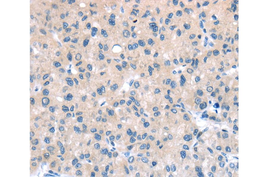 Immunohistochemistry - TTI1 Antibody from Signalway Antibody (40271) - Antibodies.com