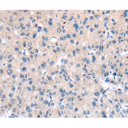 Immunohistochemistry - TTI1 Antibody from Signalway Antibody (40271) - Antibodies.com