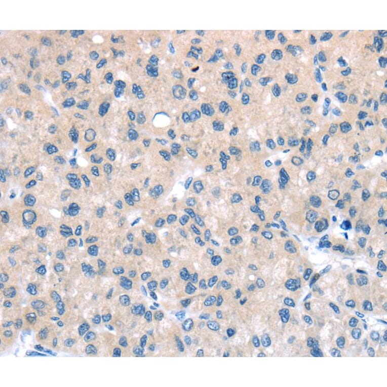 Immunohistochemistry - TTI1 Antibody from Signalway Antibody (40271) - Antibodies.com