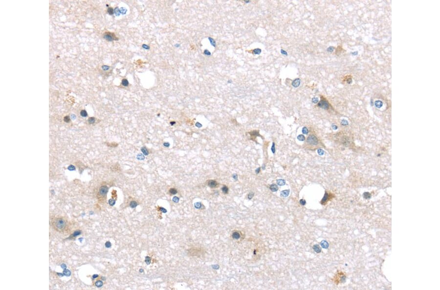 Immunohistochemistry - TTI1 Antibody from Signalway Antibody (40271) - Antibodies.com