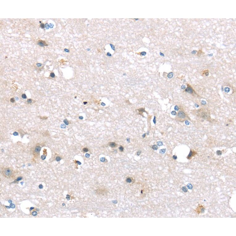 Immunohistochemistry - TTI1 Antibody from Signalway Antibody (40271) - Antibodies.com