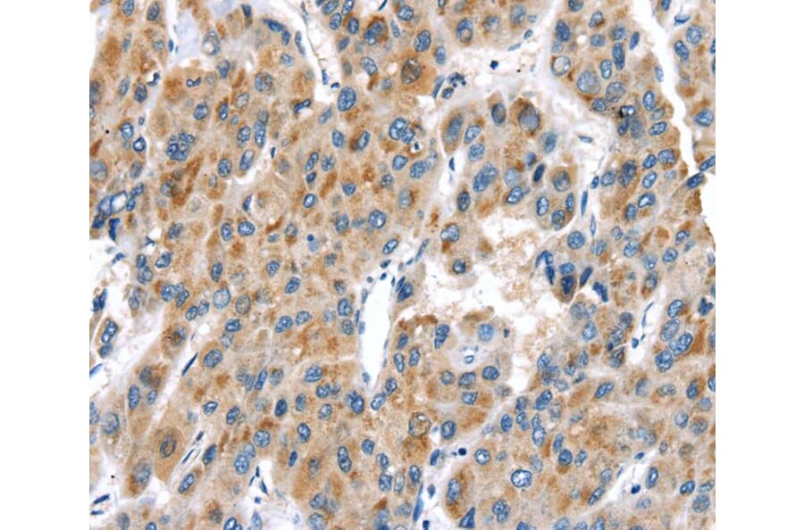 Immunohistochemistry - UCP2 Antibody from Signalway Antibody (40280) - Antibodies.com