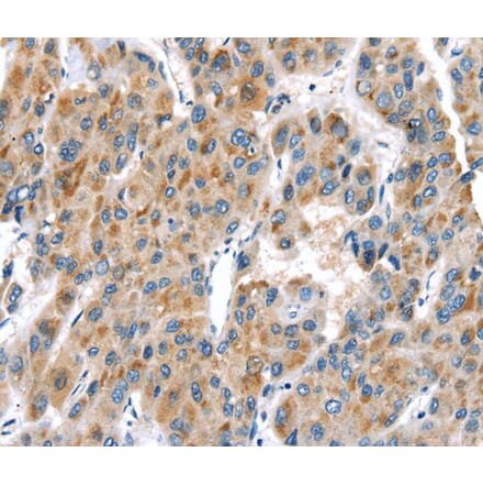 Immunohistochemistry - UCP2 Antibody from Signalway Antibody (40280) - Antibodies.com