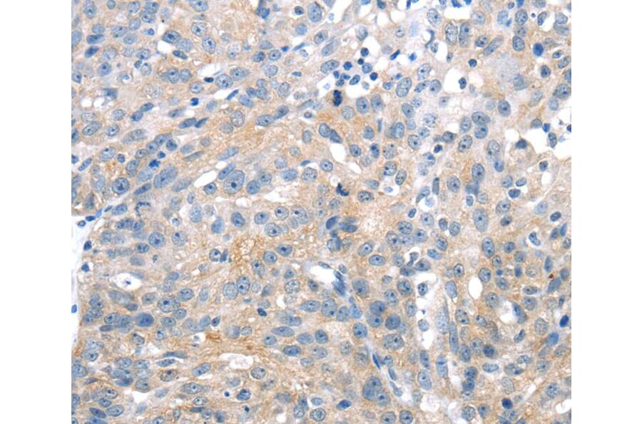 Immunohistochemistry - UCP2 Antibody from Signalway Antibody (40280) - Antibodies.com