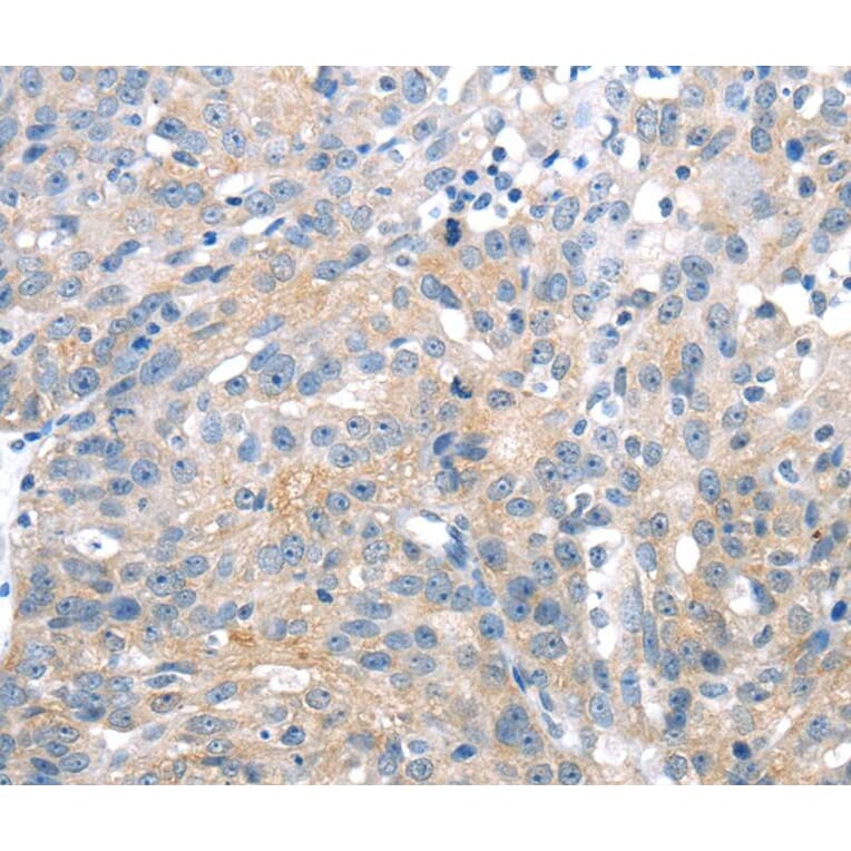 Immunohistochemistry - UCP2 Antibody from Signalway Antibody (40280) - Antibodies.com