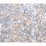 Immunohistochemistry - UCP2 Antibody from Signalway Antibody (40280) - Antibodies.com