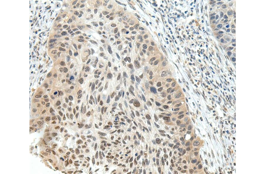 Immunohistochemistry - NSD1 Antibody from Signalway Antibody (40283) - Antibodies.com