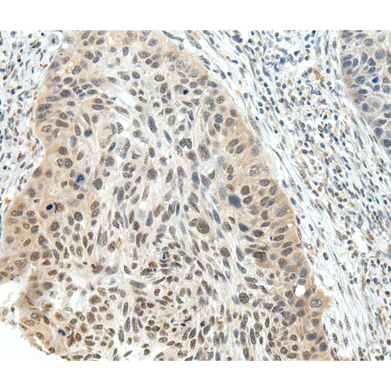 Immunohistochemistry - NSD1 Antibody from Signalway Antibody (40283) - Antibodies.com