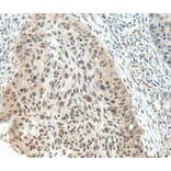 Immunohistochemistry - NSD1 Antibody from Signalway Antibody (40283) - Antibodies.com