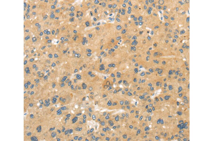 Immunohistochemistry - MPP6 Antibody from Signalway Antibody (40288) - Antibodies.com