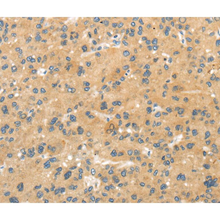 Immunohistochemistry - MPP6 Antibody from Signalway Antibody (40288) - Antibodies.com