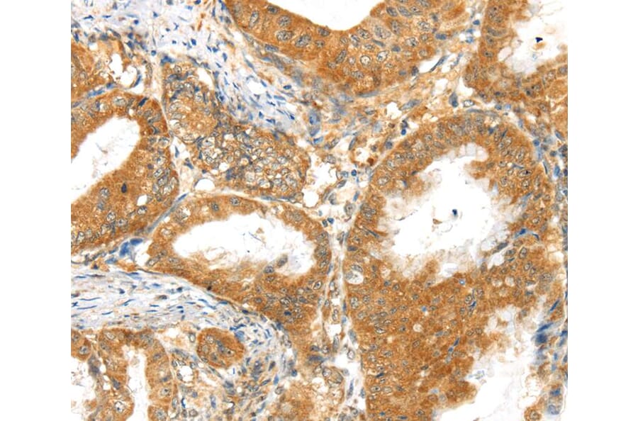 Immunohistochemistry - MPP6 Antibody from Signalway Antibody (40288) - Antibodies.com
