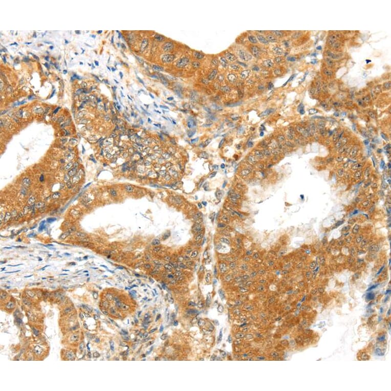 Immunohistochemistry - MPP6 Antibody from Signalway Antibody (40288) - Antibodies.com