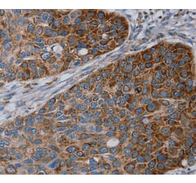 Immunohistochemistry - REG4 Antibody from Signalway Antibody (40321) - Antibodies.com