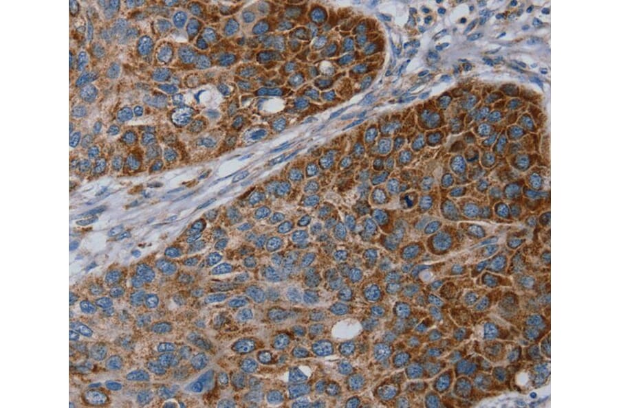 Immunohistochemistry - REG4 Antibody from Signalway Antibody (40321) - Antibodies.com
