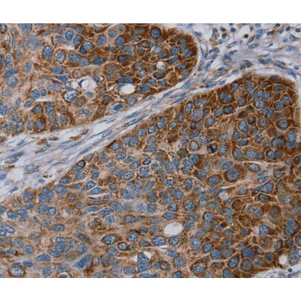 Immunohistochemistry - REG4 Antibody from Signalway Antibody (40321) - Antibodies.com