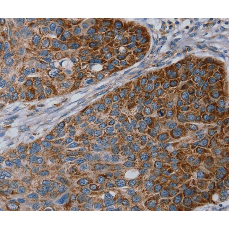 Immunohistochemistry - REG4 Antibody from Signalway Antibody (40321) - Antibodies.com